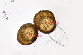 Attēlu rezultāti vaicājumam “Tortula truncata sporophyte”