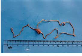 Attēlu rezultāti vaicājumam “Gordius aquaticus”