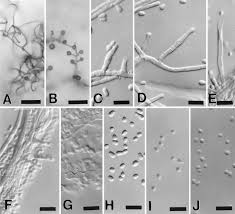 Attēlu rezultāti vaicājumam “Hyphodiscus hymeniophilus”