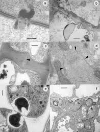 Attēlu rezultāti vaicājumam “Sphacelotheca hydropiperis”