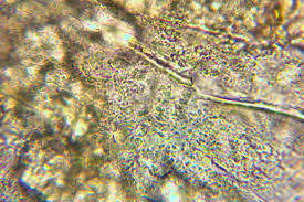 Attēlu rezultāti vaicājumam “Arcyria cinerea spores”