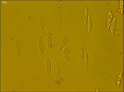 Attēlu rezultāti vaicājumam “Hypomyces armeniacus”