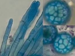 Attēlu rezultāti vaicājumam “Lamprospora tortulae-ruralis”