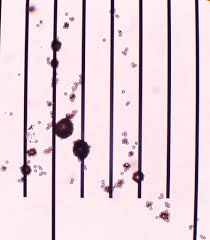 Attēlu rezultāti vaicājumam “Willkommlangea reticulata spores”