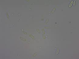 Attēlu rezultāti vaicājumam “Elmerina caryae”