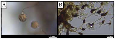 Attēlu rezultāti vaicājumam “Didymium serpula spores”