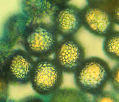 Attēlu rezultāti vaicājumam “Hemitrichia karstenii”