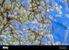 Attēlu rezultāti vaicājumam “Craterium minutum spores”