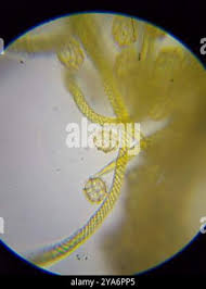 Attēlu rezultāti vaicājumam “Oligonema favogineum”