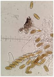 Attēlu rezultāti vaicājumam “Stemonitopsis aequalis (var. aequalis) spores”