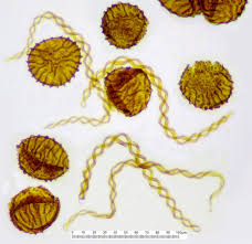 Attēlu rezultāti vaicājumam “Lycogala botrydium spores”