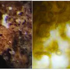 Attēlu rezultāti vaicājumam “Oligonema persimile spores”