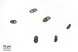 Attēlu rezultāti vaicājumam “Calicium viride”