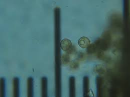 Attēlu rezultāti vaicājumam “Cribraria rufa spores”