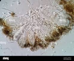 Attēlu rezultāti vaicājumam “Scoliciosporum chlorococcum”