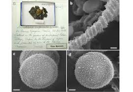 Attēlu rezultāti vaicājumam “Hemitrichia leiotricha spores”