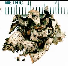 Attēlu rezultāti vaicājumam “Dermatocarpon miniatum”