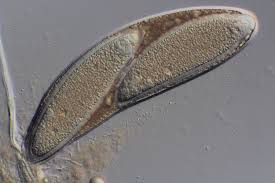 Attēlu rezultāti vaicājumam “Pertusaria pertusa”