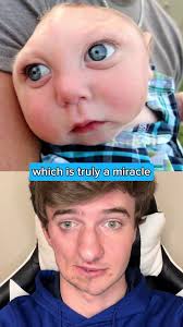 Image result for no brain