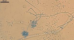 Attēlu rezultāti vaicājumam “Badhamiopsis praetermissa spores”