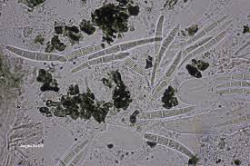 Attēlu rezultāti vaicājumam “Lecanactis abietina”