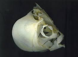 Image result for Ictiobus cyprinellus