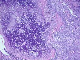 Attēlu rezultāti vaicājumam “Diderma chondrioderma macro”