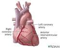 Anterior heart <b>arteries</b>