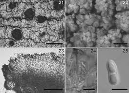 Attēlu rezultāti vaicājumam “Hertelidea botryosa”