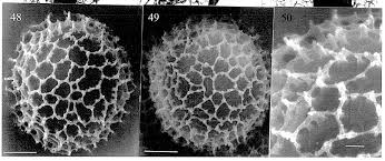 Attēlu rezultāti vaicājumam “Stemonitis herbatica spores”