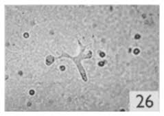 Attēlu rezultāti vaicājumam “Stemonitis herbatica spores”