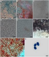 Attēlu rezultāti vaicājumam “Sphaerobolus stellatus”