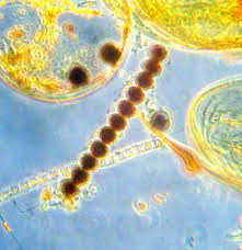 Attēlu rezultāti vaicājumam “Physarum alexandrowiczii sessile”