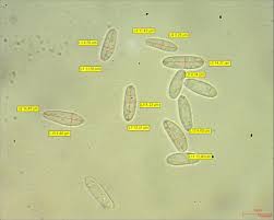Attēlu rezultāti vaicājumam “Cudoniella clavus”