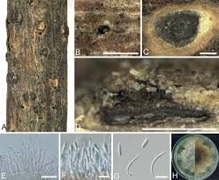 Attēlu rezultāti vaicājumam “Diachea muscorum spores”