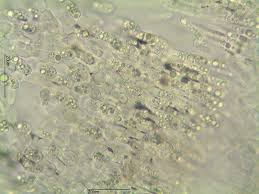 Attēlu rezultāti vaicājumam “Hymenoscyphus imberbis”