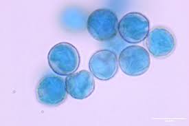 Attēlu rezultāti vaicājumam “Clastoderma debaryanum spores”