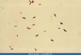 Attēlu rezultāti vaicājumam “Claustria didermoides spores”