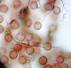 Attēlu rezultāti vaicājumam “Diderma chondrioderma spores”