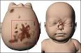 Baby P. Image 1 of 2