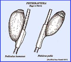 Attēlu rezultāti vaicājumam “Licea pygmaea sessile”
