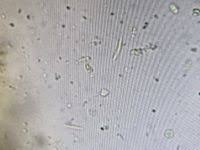 Attēlu rezultāti vaicājumam “Hyalorbilia inflatula”