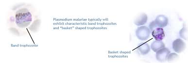 Attēlu rezultāti vaicājumam “undetermined plasmodium”