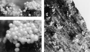 Attēlu rezultāti vaicājumam “Clastoderma debaryanum spores”