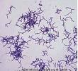 Gram-Positive <b>Streptomyces</b>