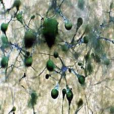 Attēlu rezultāti vaicājumam “Colloderma sp.”