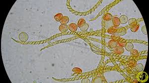 Attēlu rezultāti vaicājumam “Hemitrichia leiotricha spores”