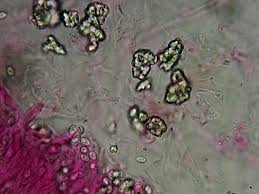 Attēlu rezultāti vaicājumam “Ombrophila violacea spores”