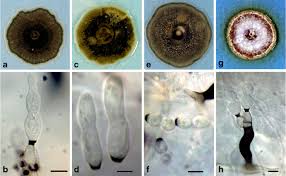 Attēlu rezultāti vaicājumam “Heterotrichia pomiformis (syn. Arcyria pomiformis)”