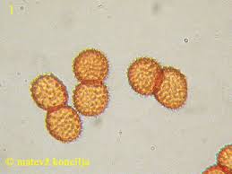 Attēlu rezultāti vaicājumam “Tranzschelia pruni-spinosae”